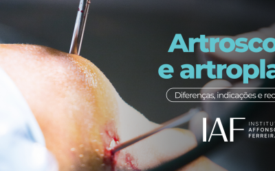 Artroscopia e artroplastia: diferenças, indicações e recuperação